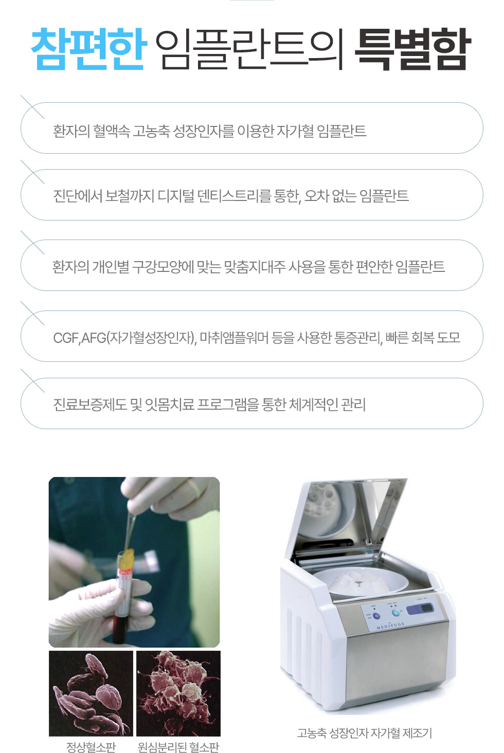 참편한 임플란트의 특별함