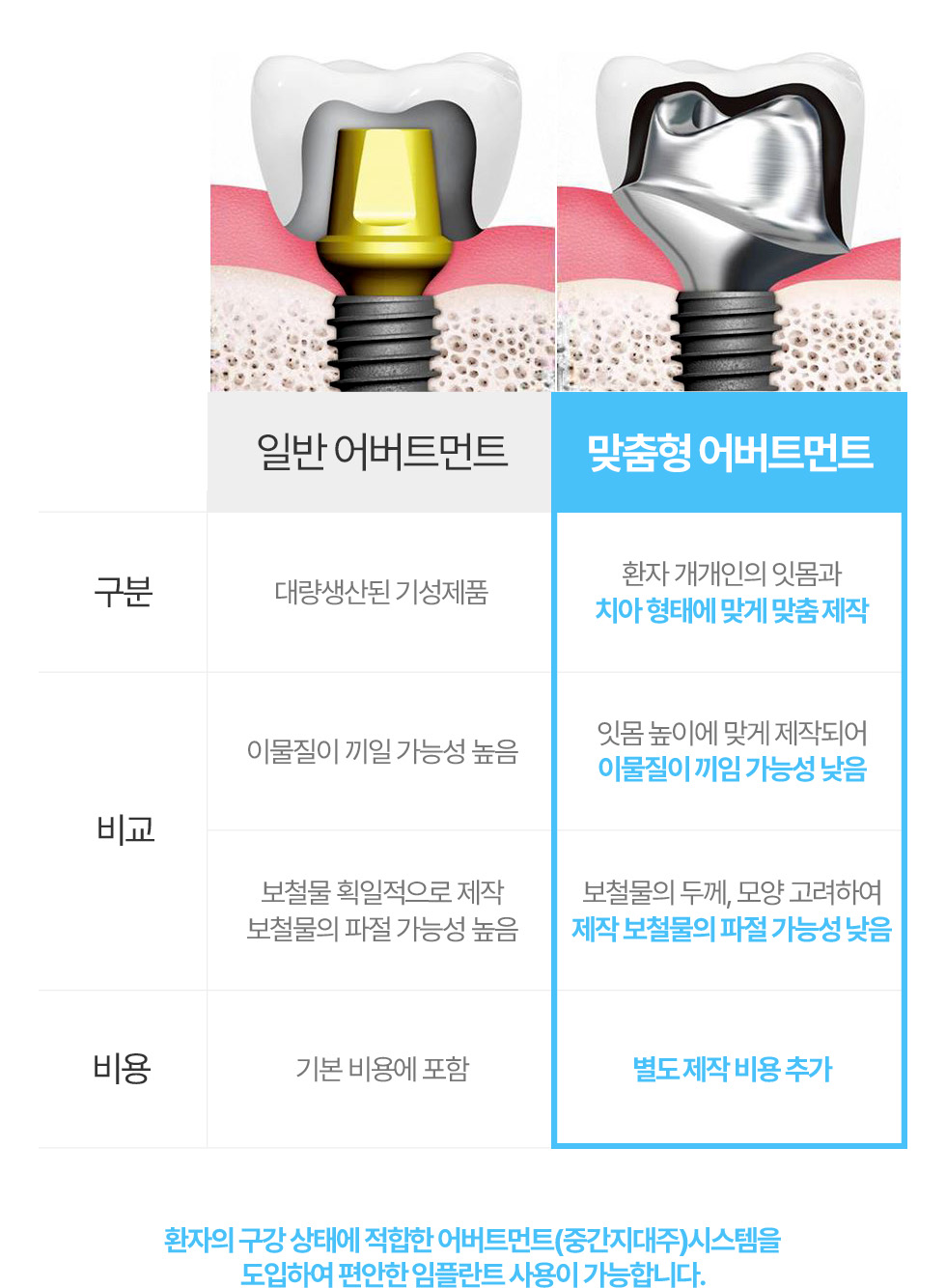 일반,맞춤형 어버트먼트