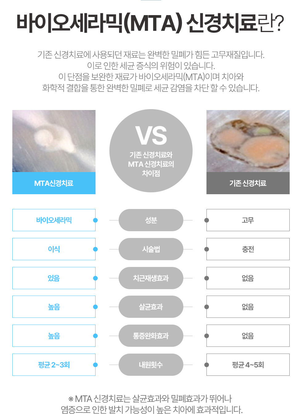 바이오세라믹(MTA) 신경치료란? 