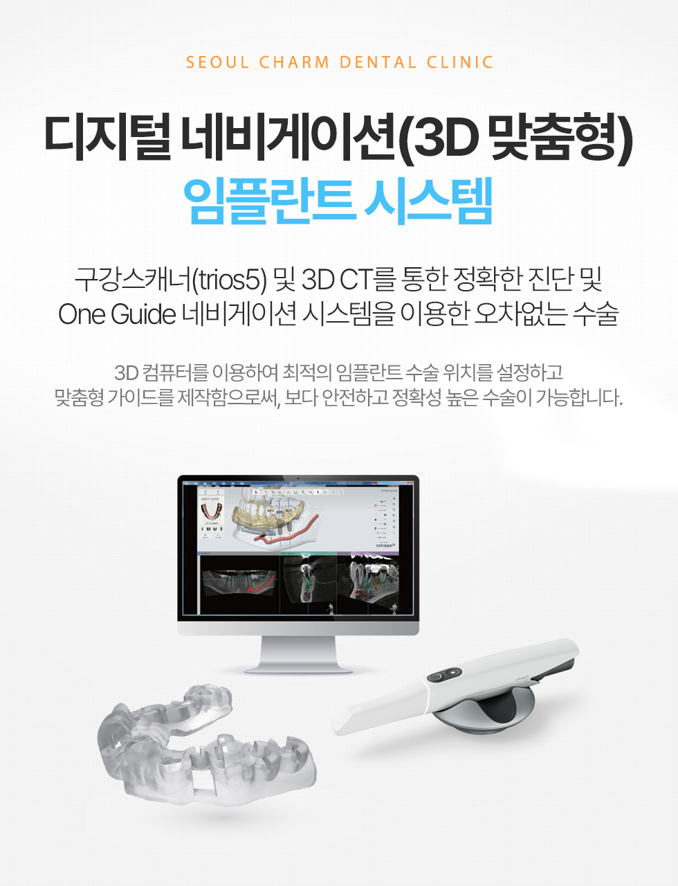디지털 네비게이션(3D 맞춤형) 임플란트 시스템
