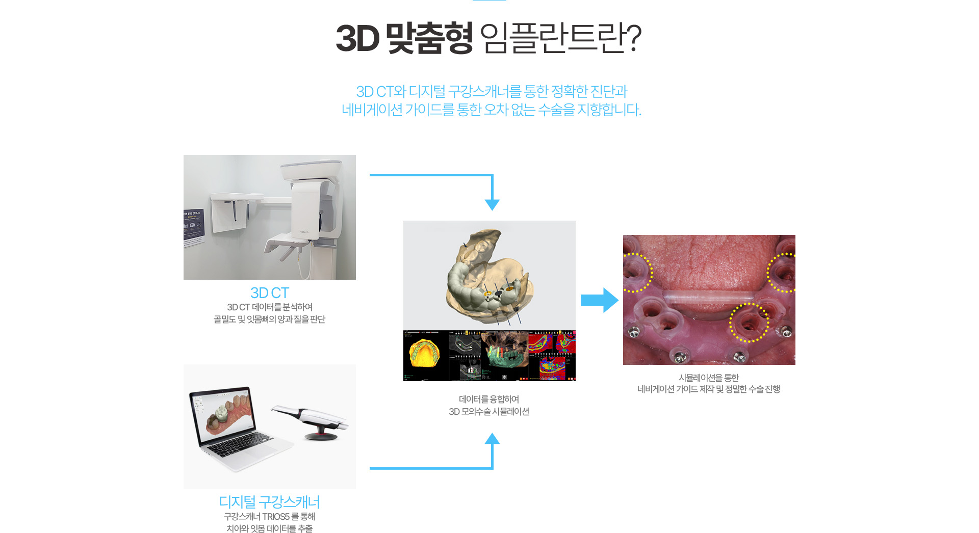 3D 맞춤형 임플란트란?