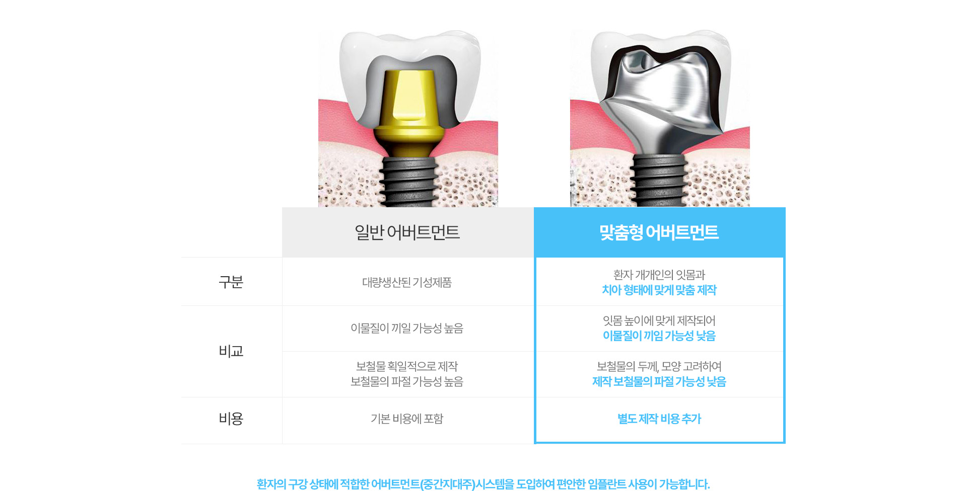 일반,맞춤형 어버트먼트