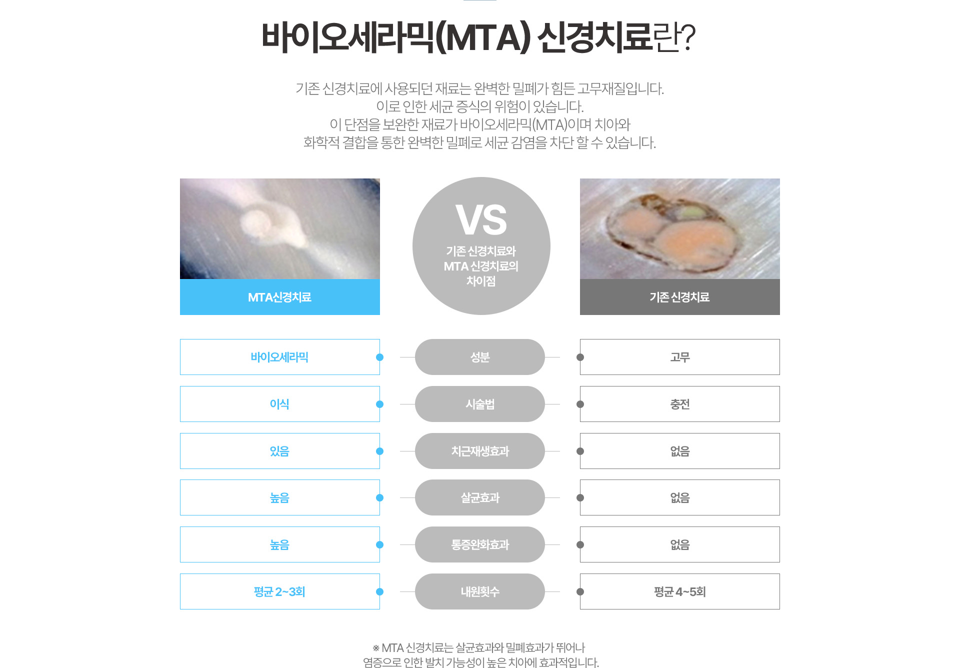 바이오세라믹(MTA) 신경치료란? 
