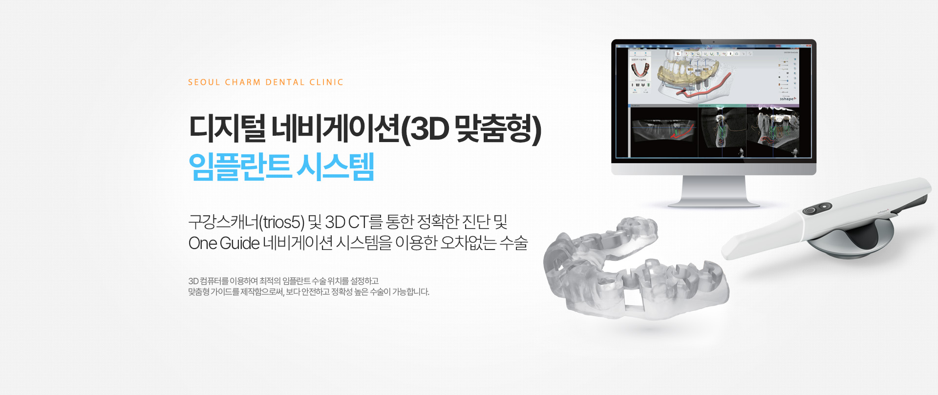 디지털 네비게이션(3D 맞춤형) 임플란트 시스템